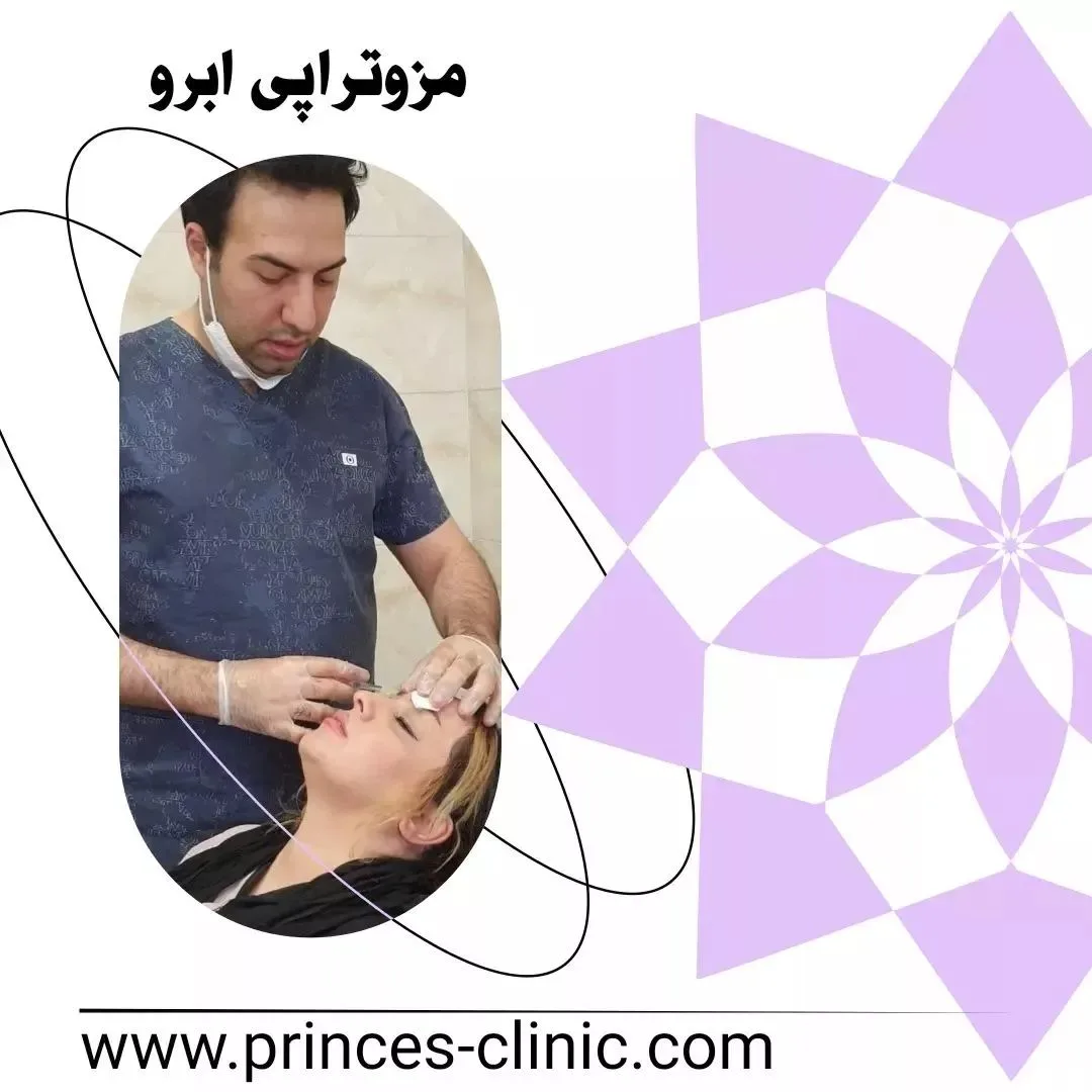 مزوتراپی ابرو در کلینیک دکتر امید شعبانی