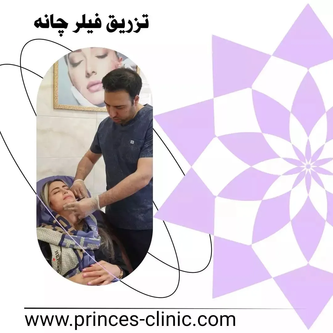 تزریق فیلر چانه در کلینیک دکتر امید شعبانی