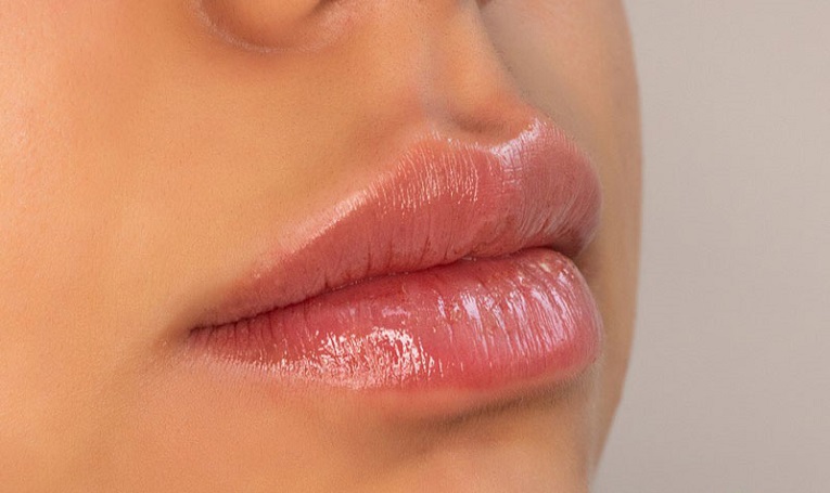 برترین کلینیک تزریق ژل لب در کرج