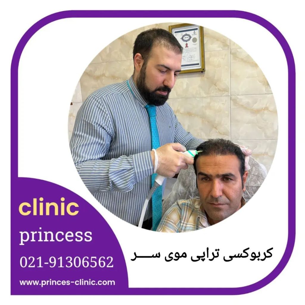 مزوتراپی
