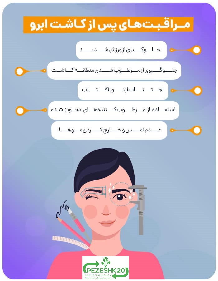 کاشت ابرو