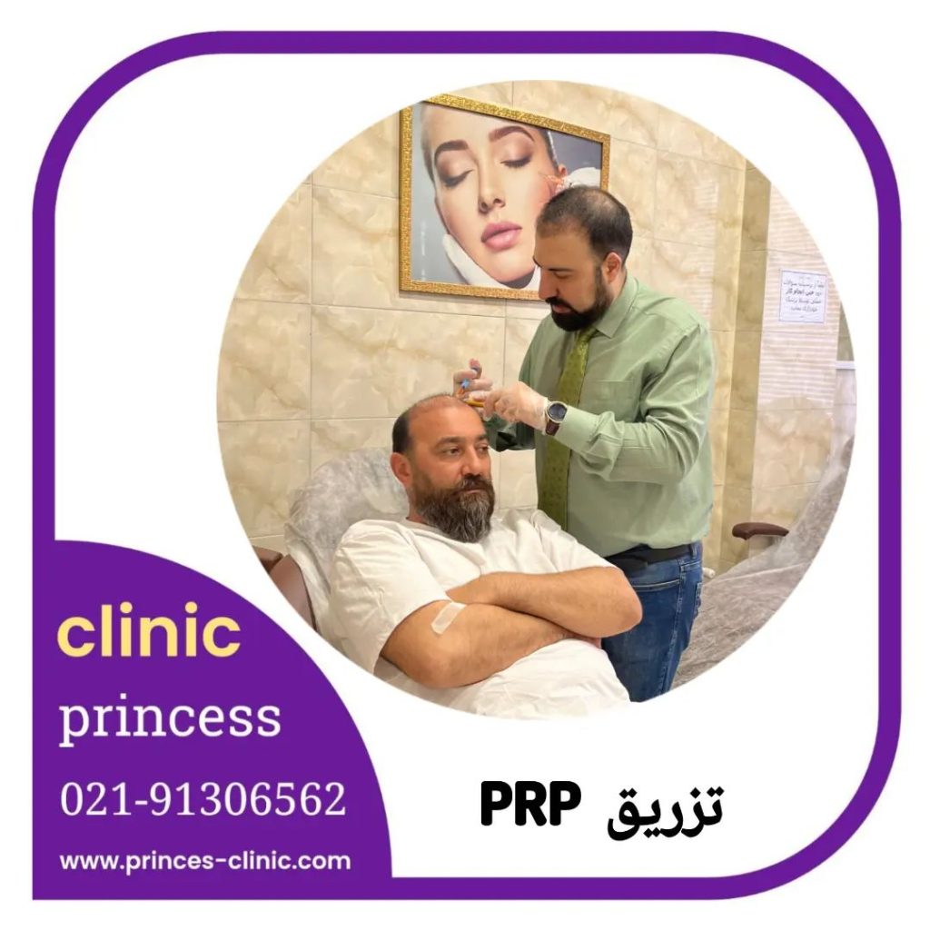 تزریق پی آر پی