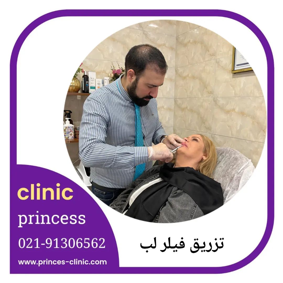تزریق فیلر
