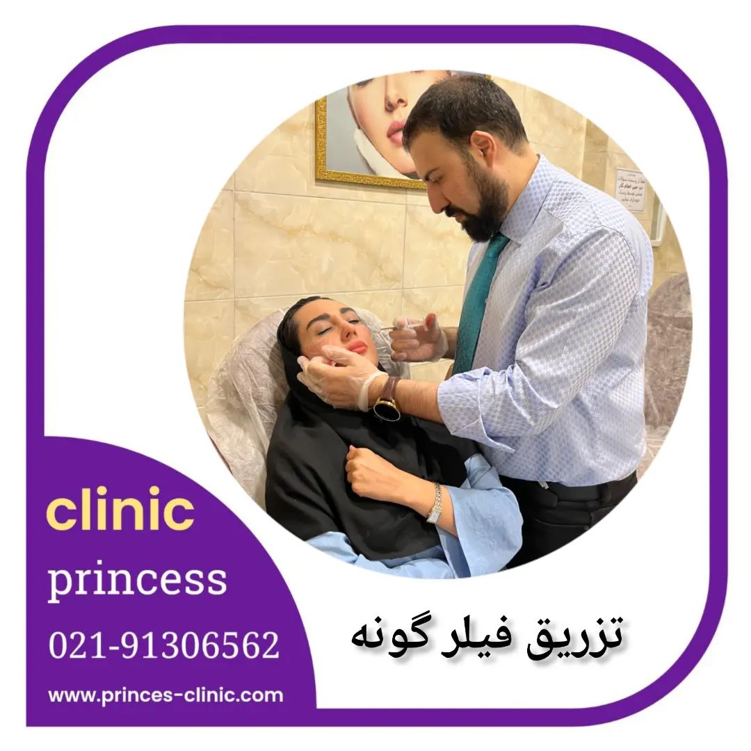 فیلر گونه