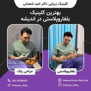 بهترین کلینیک و جراح پلک بلفاروپلاستی در اندیشه