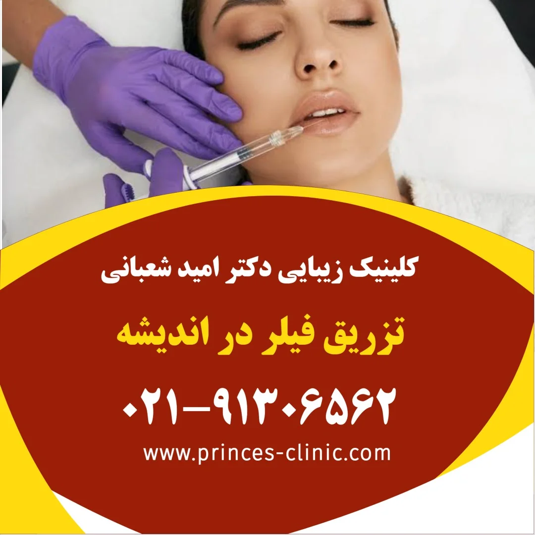 تزریق فیلر در اندیشه در کلینیک زیبایی پرنسس