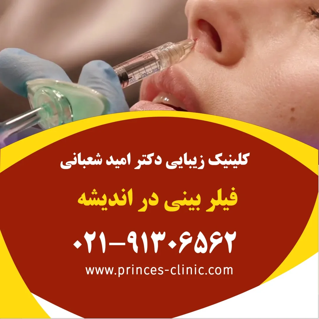 فیلر بینی در اندیشه در کلینیک زیبایی پرنسس