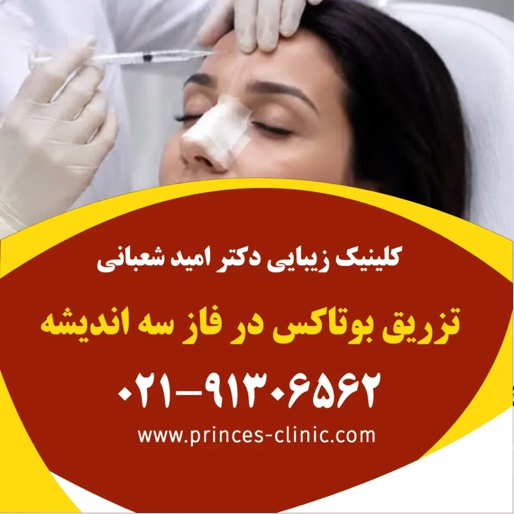 تزریق بوتاکس در فاز سه اندیشه در کلینیک زیبایی پرنسس