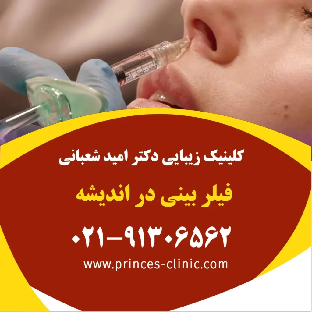 فیلر بینی در اندیشه در کلینیک زیبایی پرنسس