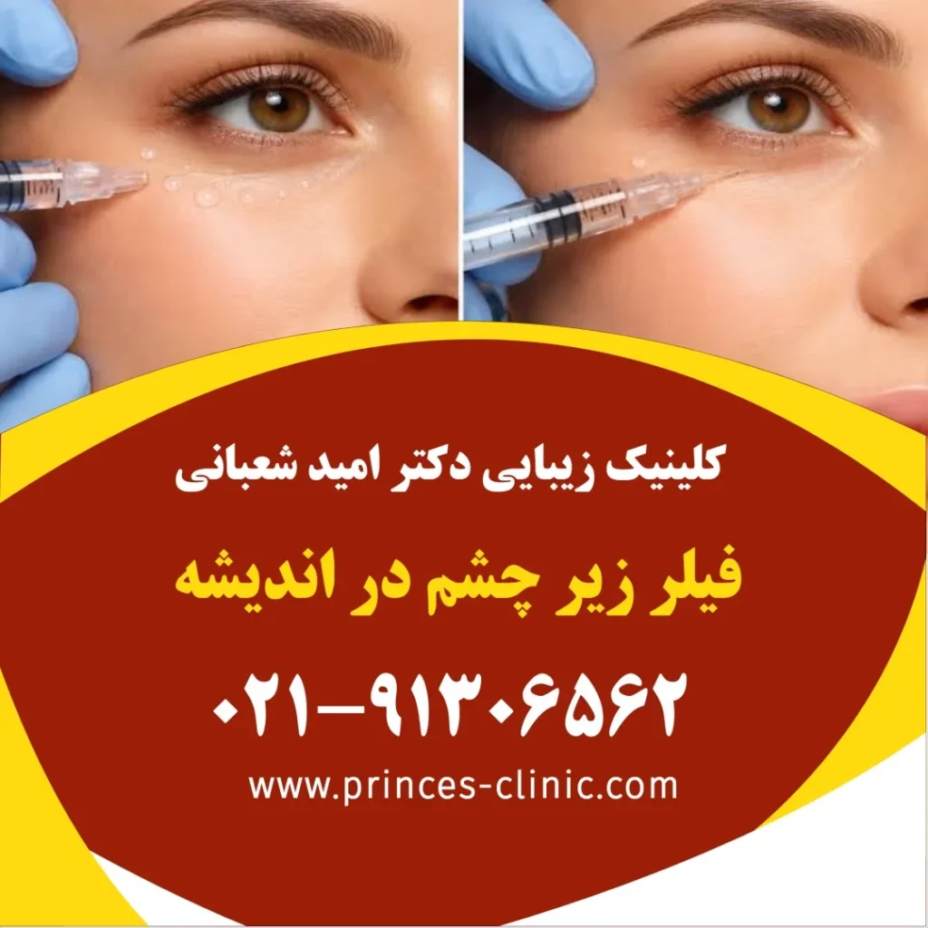 فیلر زیر چشم در اندیشه در کلینیک زیبایی پرنسس