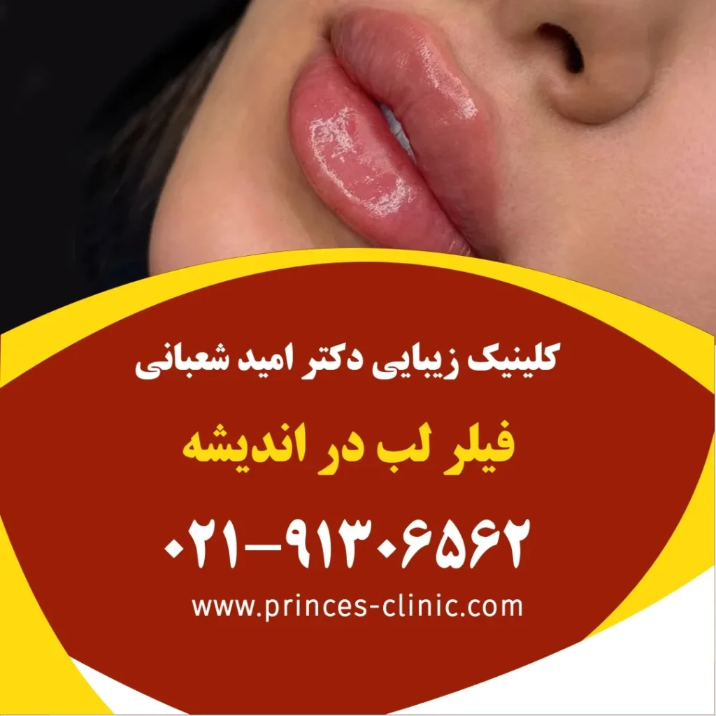 Alt: فیلر لب در اندیشه در کلینیک زیبایی پرنسس