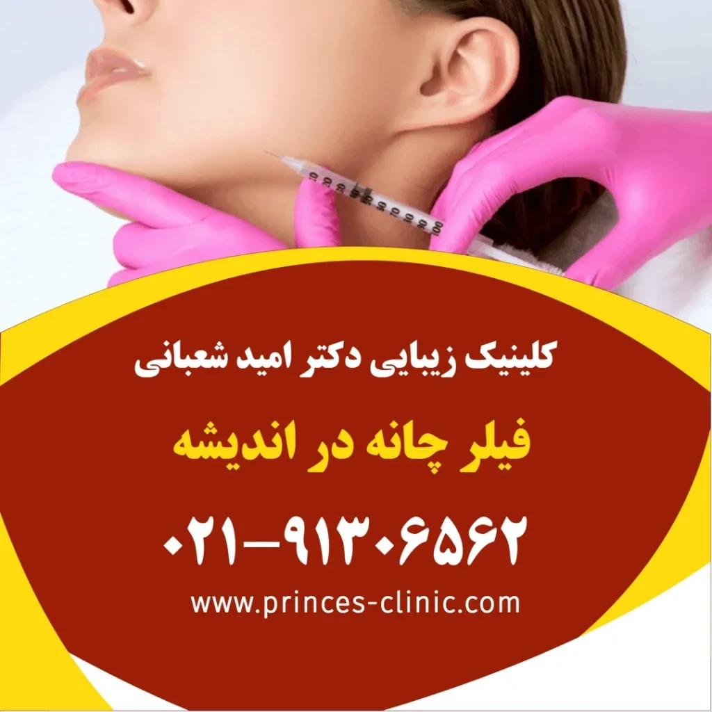 فیلر چانه در اندیشه در کلینیک زیبایی پرنسس
