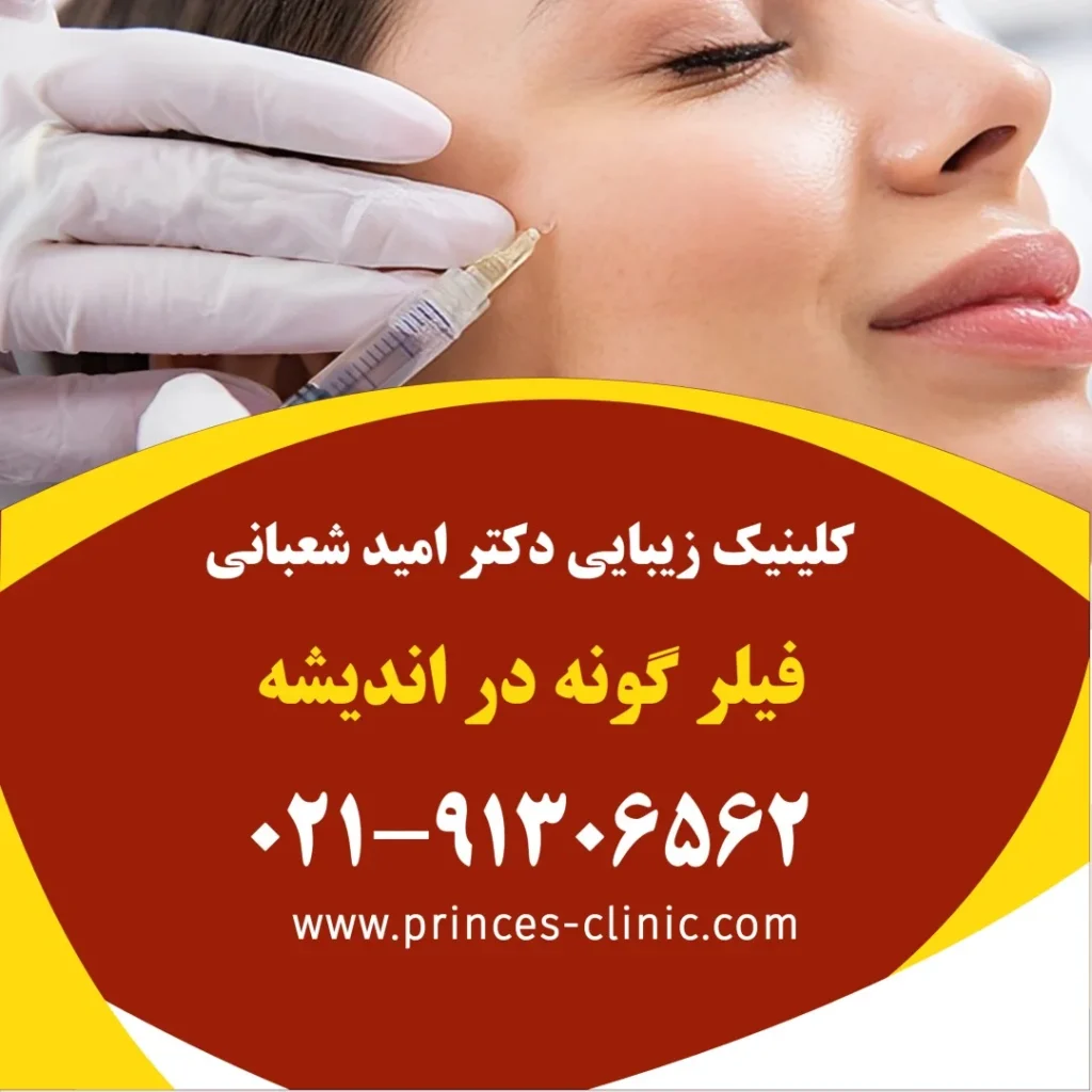 فیلر گونه در اندیشه در کلینیک زیبایی پرنسس