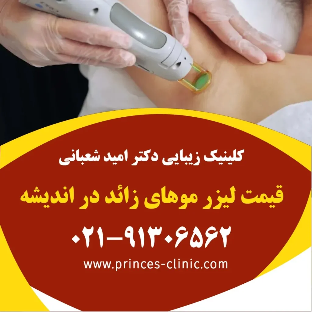 قیمت لیزر موهای زائد در اندیشه در کلینیک زیبایی پرنسس