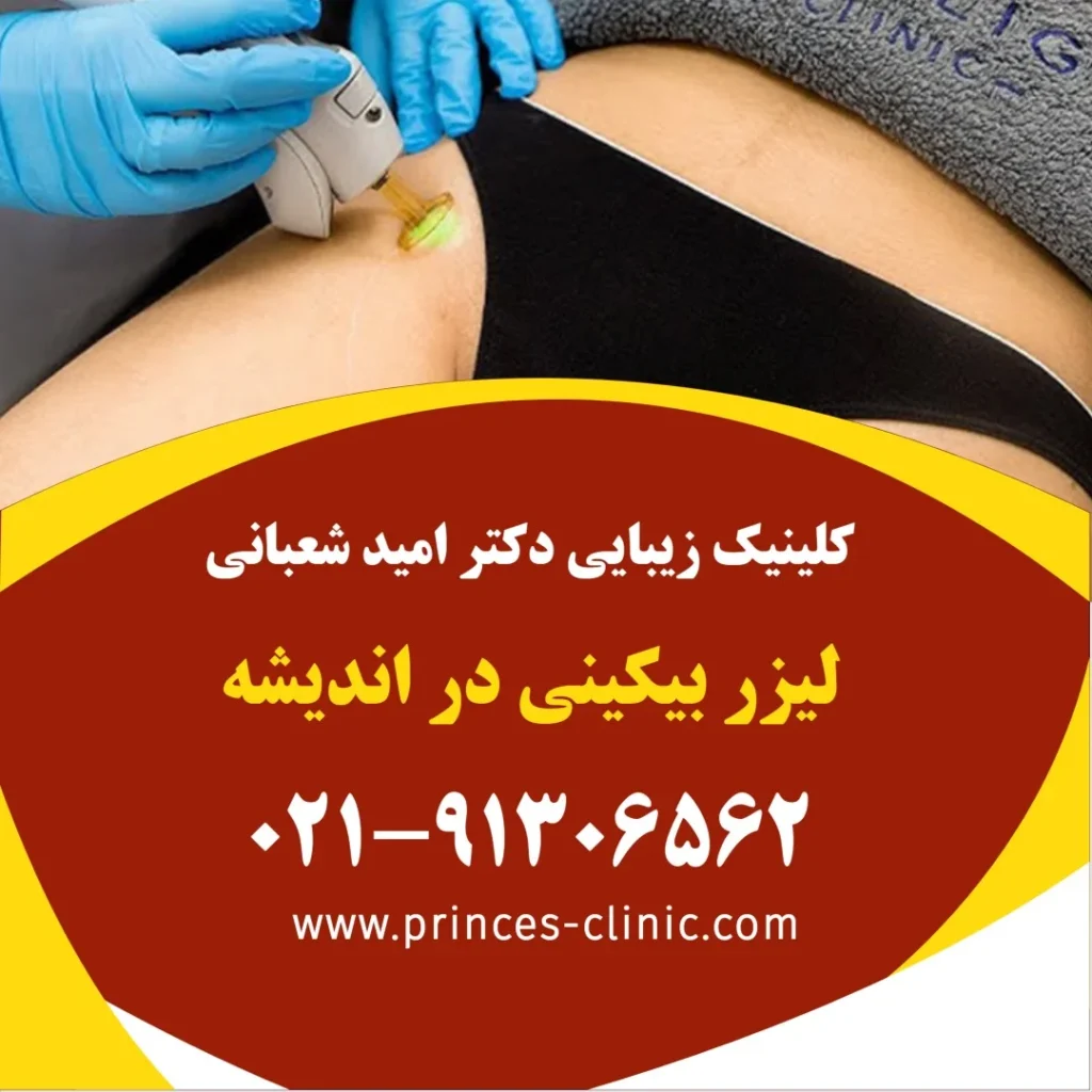 لیزر بیکینی در اندیشه در کلینیک زیبایی پرنسس