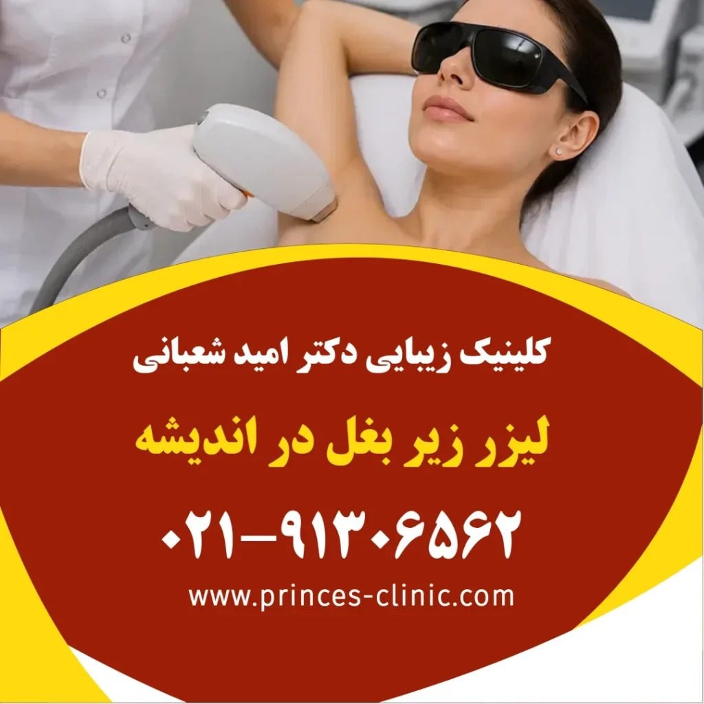 لیزر زیر بغل در اندیشه در کلینیک زیبایی پرنسس