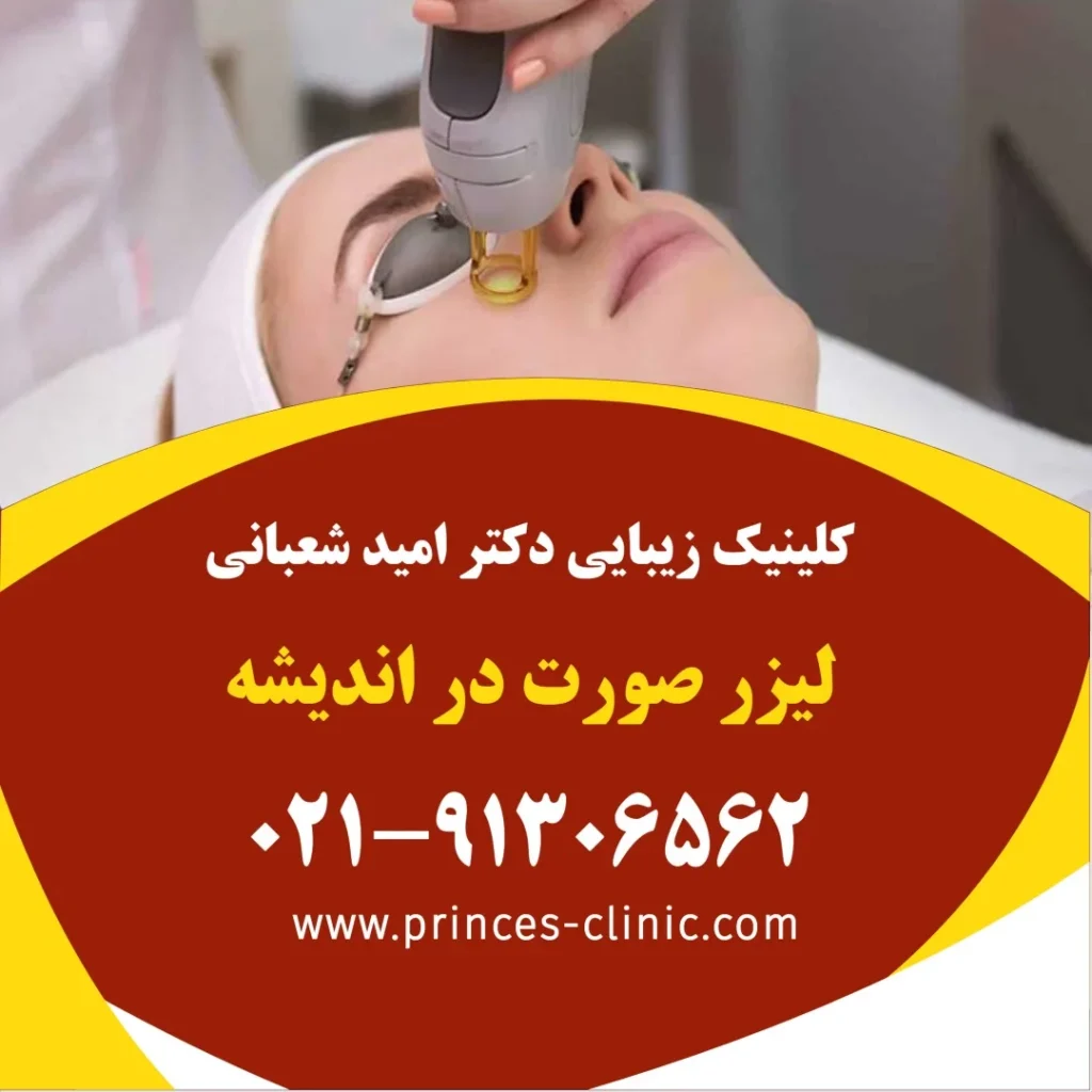 لیزر صورت در اندیشه در کلینیک زیبایی پرنسس