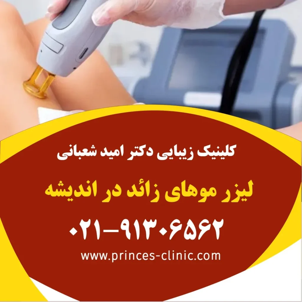 لیزر موهای زائد در اندیشه در کلینیک زیبایی پرنسس