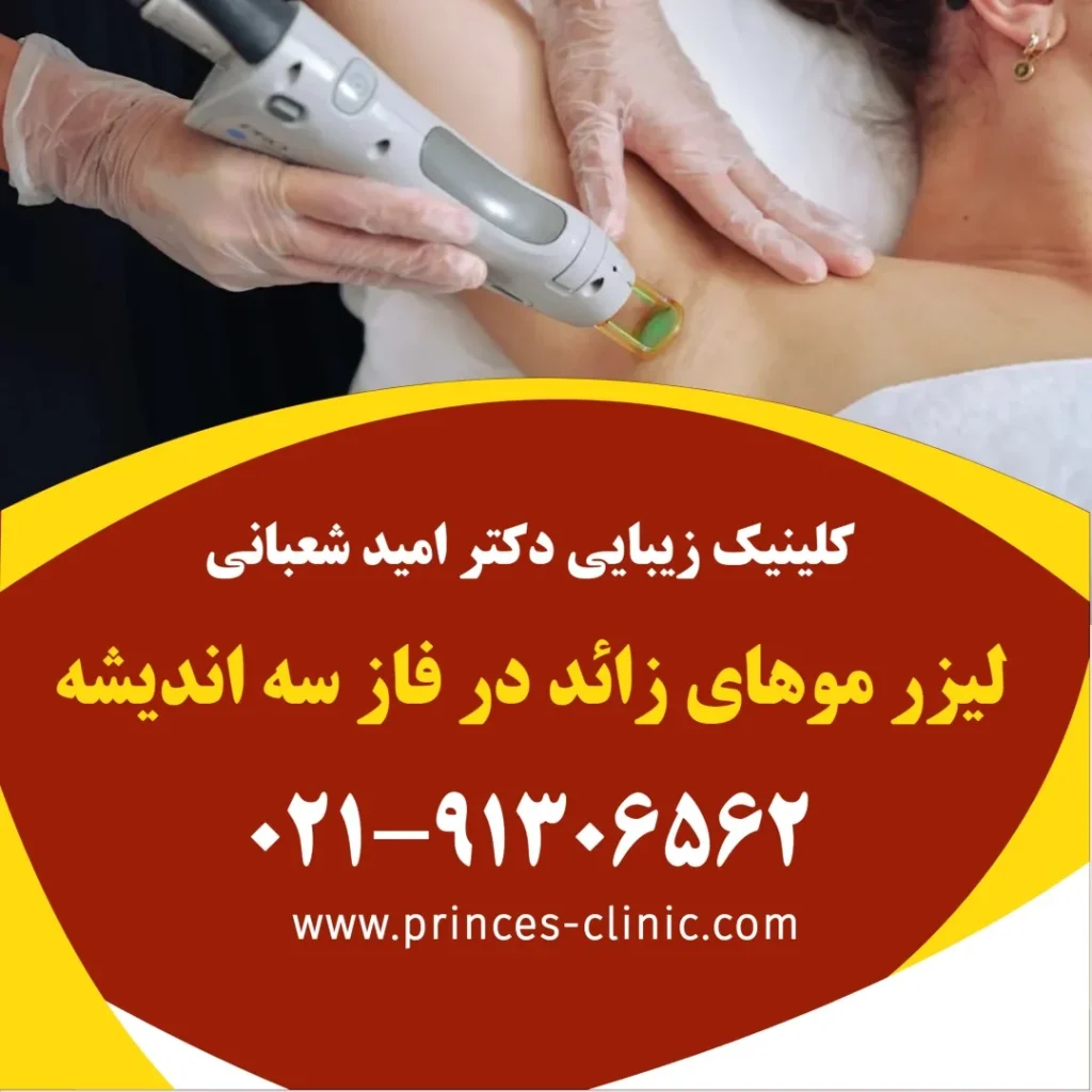 لیزر موهای زائد در فاز سه اندیشه در کلینیک زیبایی پرنسس
