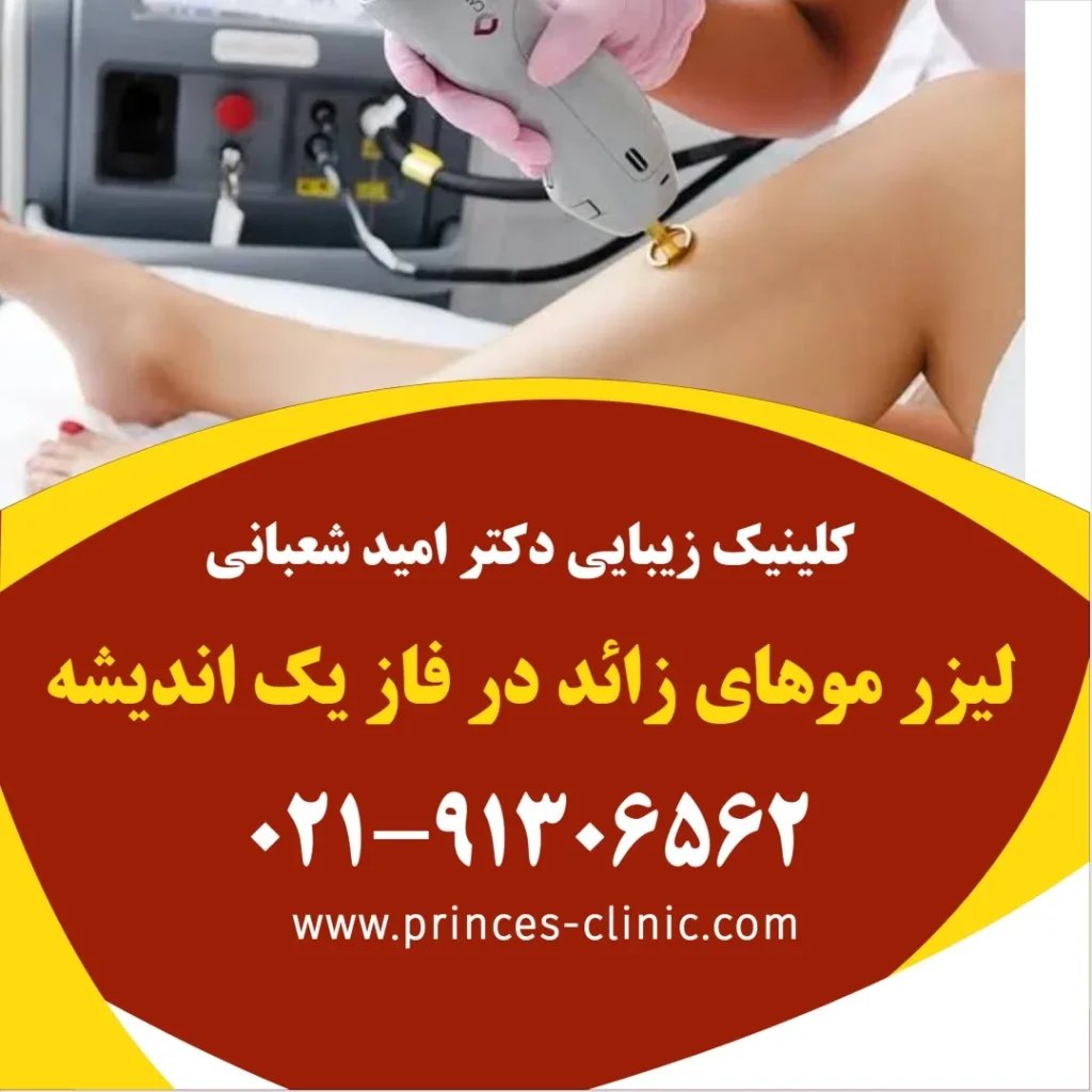 لیزر موهای زائد در فاز یک اندیشه در کلینیک زیبایی پرنسس
