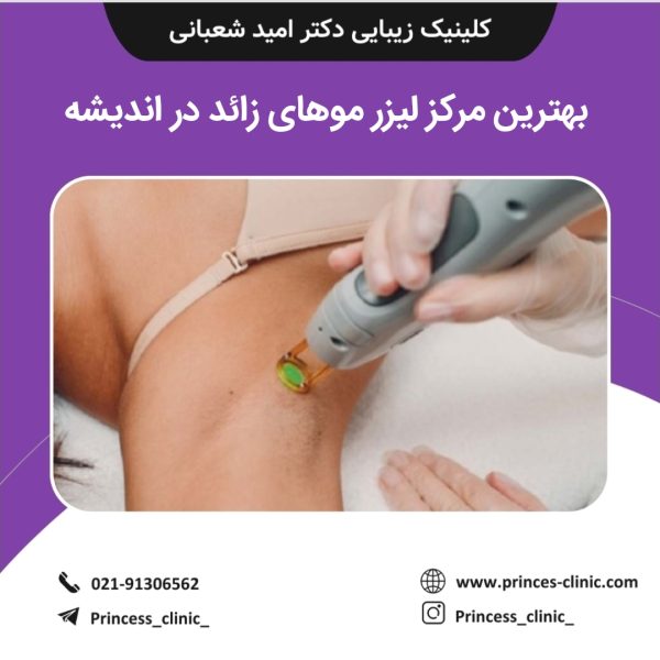 بهترین مرکز لیزر موهای زائد در اندیشه