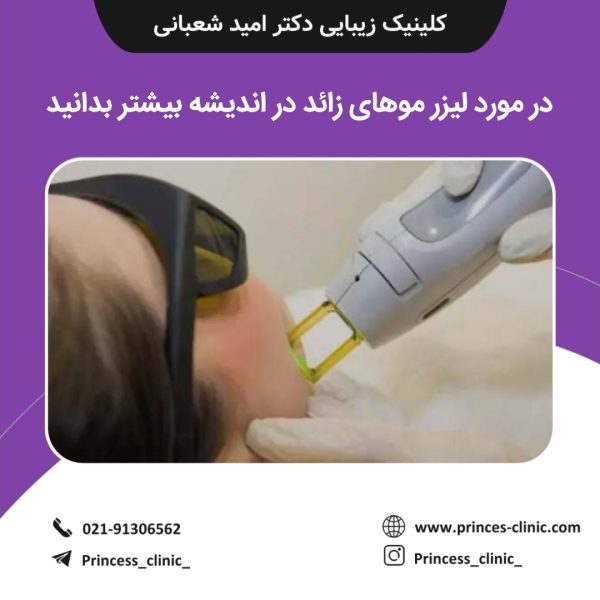 در مورد لیزر موهای زائد در اندیشه بیشتر بدانید