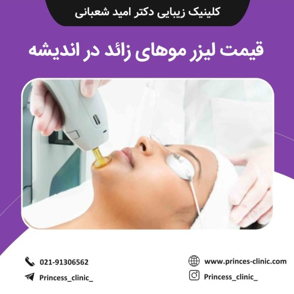 قیمت لیزر موهای زائد در اندیشه