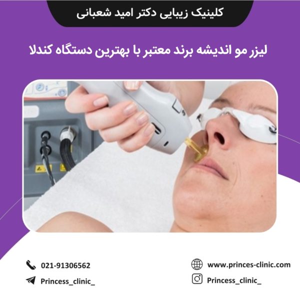 لیزر مو اندیشه برند معتبر با بهترین دستگاه کندلا