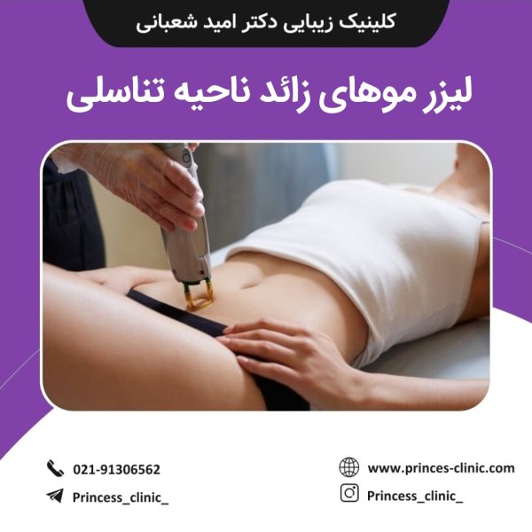 لیزر موهای زائد ناحیه تناسلی