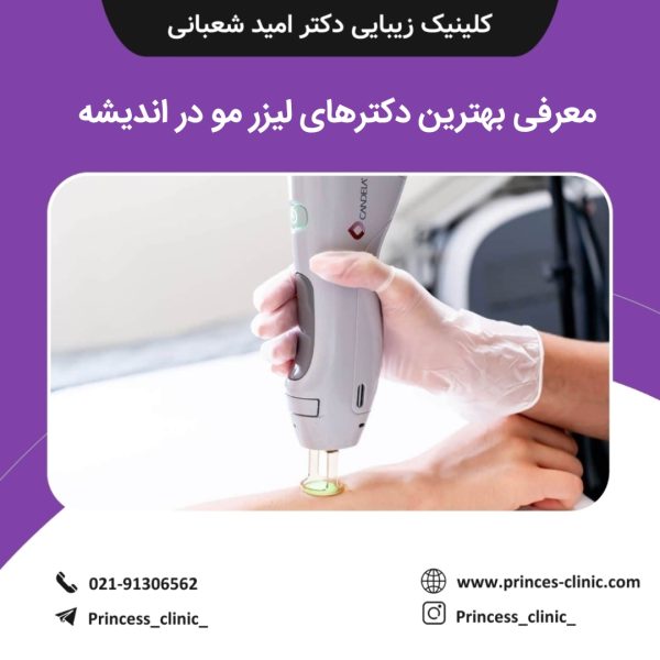 معرفی بهترین دکترهای لیزر مو در اندیشه